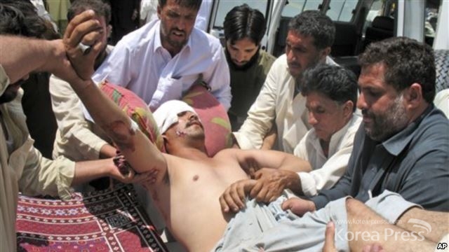 폭탄테러로 부상입은 파키스탄 주민