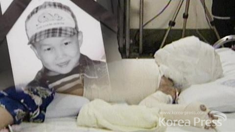 '어린이 황산 테러'로 49일 만에 사망한 故 김태완 군 방송 자료 캡처